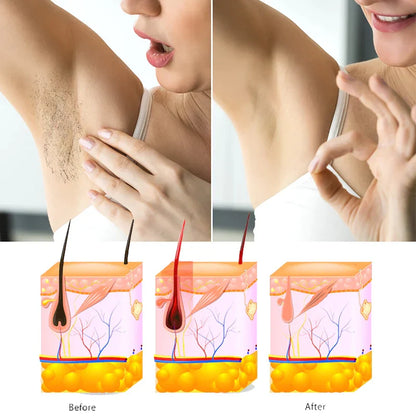 Heaven Dove Hair Removal Spray (Unisex)-Productzone.pk